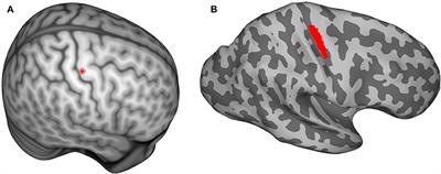 TMS Motor Thresholds Correlate With TDCS Electric Field Strengths in Hand Motor Area